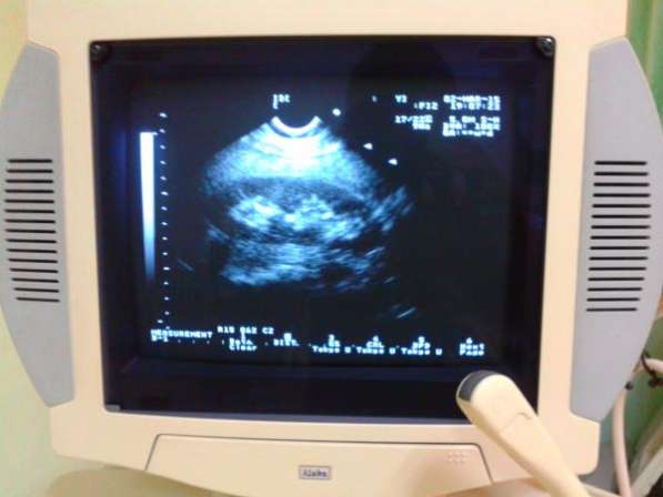 ALOKA Алока 1400 аппарат сканер УЗИ ультразвуковой диагностики в Краснодаре фото 5