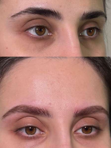 Бровист в Норильске фото 7